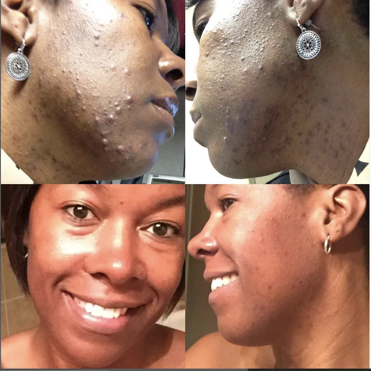 Charcoal & Tea Tree Facial Cleanser